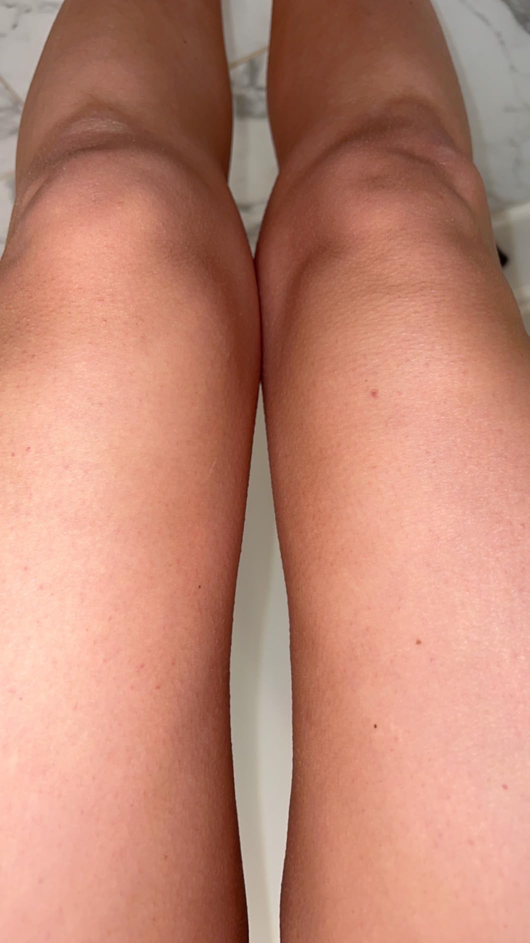 POPCHOSE Dry Brush for Lymphatic Drainage, Dry Brushing Body Brush customer photo 1